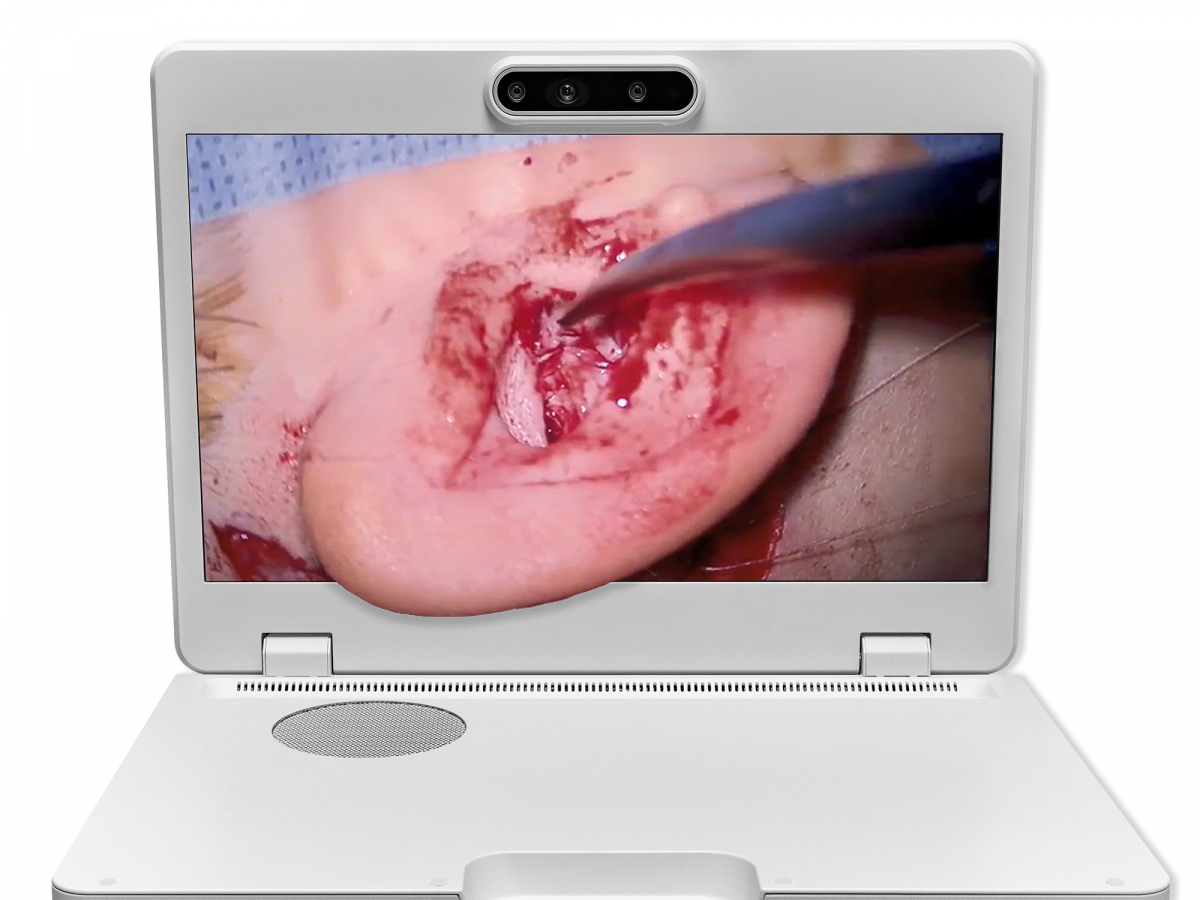 达擎之＂Heads-up 3D显微手术显示系统＂，整合4K裸眼3D显示及眼球追踪系统，具备快速追踪人眼移动位置功能，减轻医师长时间维持固定姿势的负担，让医师能有更宽广清晰的3D立体视野及更舒适的姿势来执行手术。